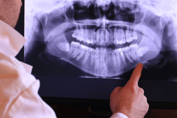 Best Emergency Treatment for Oral Infections in Whiteville, TN