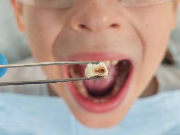 Best Emergency Treatment for Jaw Pain or Injury in Whiteville, TN